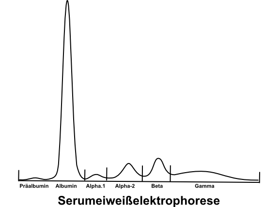 Serumproteinelektrophorese